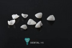 emax-veneers-Mega-dental-6