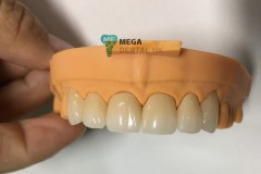 Multi-layer FullZirconia Mega Dental Images