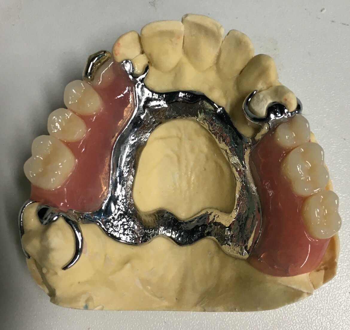 Removable Denture Mega Dental Removable Denture Mega Dental